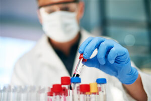 Dental professional handling blood in a tube, at a lab.